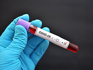 covid-19 (cloroquina) 